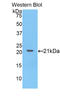 Collagen Type VIII Alpha 1 Chain antibody, LS-B11586, Lifespan Biosciences, Western Blot image 