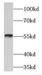 Programmed Cell Death 4 antibody, FNab06239, FineTest, Western Blot image 