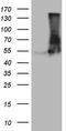 Vacuolar Protein Sorting 13 Homolog B antibody, LS-C798440, Lifespan Biosciences, Western Blot image 