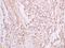 Secreted Frizzled Related Protein 2 antibody, orb1540, Biorbyt, Immunohistochemistry paraffin image 