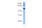 WD Repeat Domain 49 antibody, 26-783, ProSci, Western Blot image 