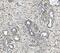 Collagen Triple Helix Repeat Containing 1 antibody, A05203-1, Boster Biological Technology, Immunohistochemistry paraffin image 