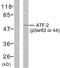 Activating Transcription Factor 2 antibody, LS-C117295, Lifespan Biosciences, Western Blot image 