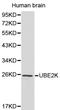 Ubiquitin Conjugating Enzyme E2 K antibody, LS-C192361, Lifespan Biosciences, Western Blot image 