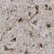 BCL2 Associated Athanogene 3 antibody, PA5-53818, Invitrogen Antibodies, Immunohistochemistry paraffin image 
