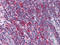 Metadherin antibody, M04060-1, Boster Biological Technology, Immunohistochemistry frozen image 