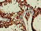 CGRP Receptor Component antibody, orb400188, Biorbyt, Immunohistochemistry paraffin image 