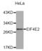 Eukaryotic Translation Initiation Factor 4E Family Member 2 antibody, abx003198, Abbexa, Western Blot image 