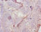 Anti-Mullerian Hormone antibody, LS-C317918, Lifespan Biosciences, Immunohistochemistry paraffin image 
