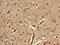 EPH Receptor A5 antibody, CSB-PA007725LA01HU, Cusabio, Immunohistochemistry paraffin image 