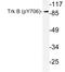 Neurotrophic Receptor Tyrosine Kinase 2 antibody, LS-C177968, Lifespan Biosciences, Western Blot image 