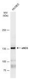 Nitric Oxide Synthase 3 antibody, GTX129113, GeneTex, Western Blot image 