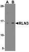 Relaxin 3 antibody, PA5-72862, Invitrogen Antibodies, Western Blot image 