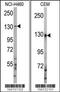 Ubiquitination Factor E4A antibody, 61-074, ProSci, Western Blot image 