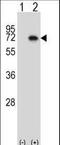 Mitogen-Activated Protein Kinase Kinase Kinase 7 antibody, LS-C164457, Lifespan Biosciences, Western Blot image 