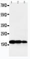 Lymphotoxin Alpha antibody, PA1361, Boster Biological Technology, Western Blot image 