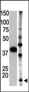 Small Ubiquitin Like Modifier 2 antibody, PA5-11369, Invitrogen Antibodies, Western Blot image 