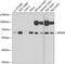Retinoid Isomerohydrolase RPE65 antibody, GTX64456, GeneTex, Western Blot image 