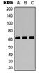 Solute Carrier Family 22 Member 4 antibody, MBS8231396, MyBioSource, Western Blot image 