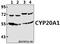 Cytochrome P450 Family 20 Subfamily A Member 1 antibody, A14222-1, Boster Biological Technology, Western Blot image 