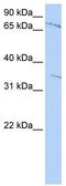 Zinc Finger Protein 224 antibody, TA339463, Origene, Western Blot image 