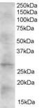 Dickkopf WNT Signaling Pathway Inhibitor 2 antibody, PA5-18015, Invitrogen Antibodies, Western Blot image 