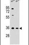 Ankyrin Repeat And SOCS Box Containing 17 antibody, PA5-24312, Invitrogen Antibodies, Western Blot image 