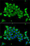 Carbonic Anhydrase 1 antibody, 13-570, ProSci, Immunofluorescence image 