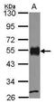 CD2 Molecule antibody, GTX101858, GeneTex, Western Blot image 