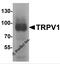 Transient Receptor Potential Cation Channel Subfamily V Member 1 antibody, 7179, ProSci, Western Blot image 