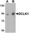 Doublecortin Like Kinase 1 antibody, LS-C108672, Lifespan Biosciences, Western Blot image 