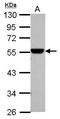 Aldehyde Dehydrogenase 1 Family Member A1 antibody, GTX123427, GeneTex, Western Blot image 