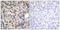 DEAD-Box Helicase 5 antibody, LS-C198877, Lifespan Biosciences, Immunohistochemistry paraffin image 