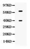 Tripeptidyl Peptidase 1 antibody, PB9899, Boster Biological Technology, Western Blot image 