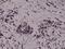 HIF1-alpha antibody, GTX33617, GeneTex, Immunohistochemistry paraffin image 