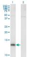 Nephrocystin 1 antibody, H00004867-B01P, Novus Biologicals, Western Blot image 