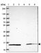 NADH:Ubiquinone Oxidoreductase Subunit S6 antibody, PA5-64161, Invitrogen Antibodies, Western Blot image 