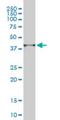 Proteasome 26S Subunit, Non-ATPase 14 antibody, H00010213-M01, Novus Biologicals, Western Blot image 