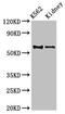 Aldehyde Dehydrogenase 1 Family Member A2 antibody, LS-C677116, Lifespan Biosciences, Western Blot image 