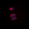 BMX Non-Receptor Tyrosine Kinase antibody, abx133130, Abbexa, Western Blot image 
