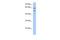 Transmembrane And Coiled-Coil Domain Family 3 antibody, A17354, Boster Biological Technology, Western Blot image 