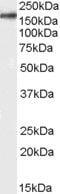 CD11b antibody, PA5-18727, Invitrogen Antibodies, Western Blot image 