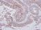 LYN Proto-Oncogene, Src Family Tyrosine Kinase antibody, PA5-27361, Invitrogen Antibodies, Immunohistochemistry frozen image 