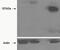 Tankyrase 2 antibody, NBP1-36993, Novus Biologicals, Western Blot image 