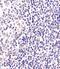 BCL6 Transcription Repressor antibody, M00142, Boster Biological Technology, Immunohistochemistry paraffin image 