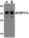 Testis Specific Protein Y-Linked 1 antibody, orb137381, Biorbyt, Western Blot image 