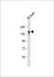 ATP Binding Cassette Subfamily B Member 11 antibody, LS-C392776, Lifespan Biosciences, Western Blot image 