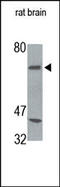 NADPH Oxidase 4 antibody, 251462, Abbiotec, Western Blot image 