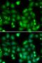 RAR Related Orphan Receptor A antibody, LS-C346166, Lifespan Biosciences, Immunofluorescence image 