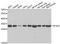 40S ribosomal protein S4, X isoform antibody, A6730, ABclonal Technology, Western Blot image 